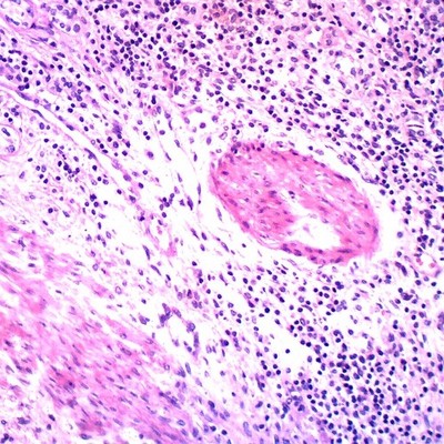 Microscope.com Omano  OMSK 50 Human Pathology Slides NIB