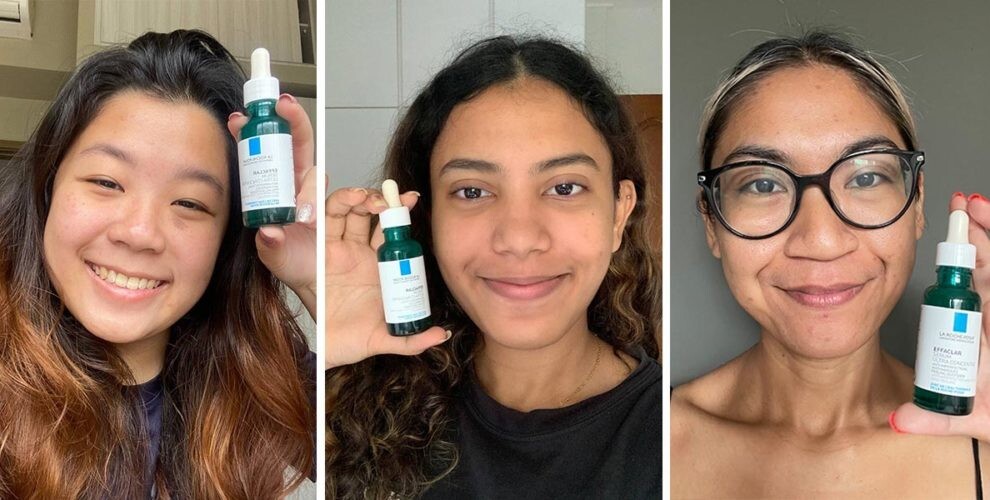 EXP2025 La Roche-Posay Effaclar 30ml Ultra Concentrated SERUM Marks Peeling Acne