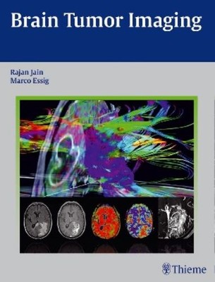 Rajan Jain Marco Essig Brain Tumor Imaging (Relié)
