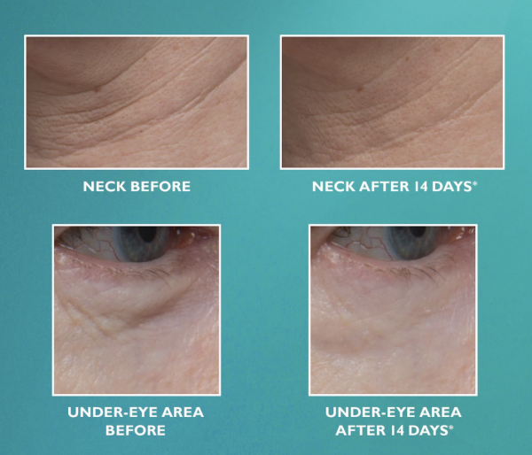 Argireline Matrixyl 3000 Hyaluronic Acid Peptide Serum Wrinkle Collagen Cream