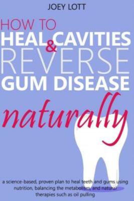 How To Heal Cavities And Reverse Gum Disease Naturally: A Science-Based, Pr...
