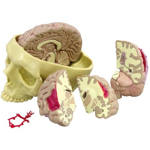Brain Human GPI Anatomical Model 5pc MOST POPULAR  LFA #2900 Make Us an Offer!