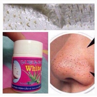 Blackhead Whitehead Pimple Pore Acne Cream Mask Snatch Burst Removal Peel Skin