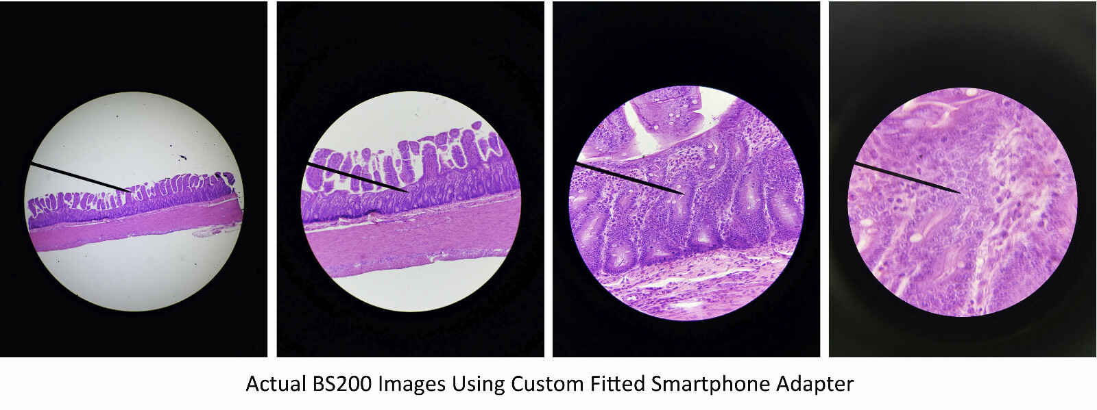 Sturdy Microscope Eyepiece Camera Adapter for Smartphone & iPhone