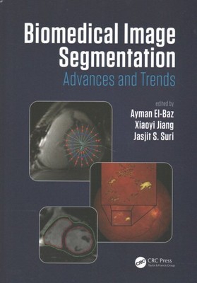 Biomedical Image Segmentation : Advances and Trends, Hardcover by El-baz, Aym...