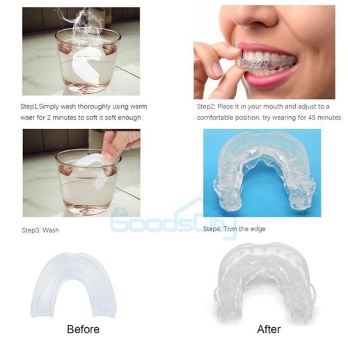 Anti Snore Mouthpiece Aid Stop Snoring Set Snore Stopper Device - Ships from USA