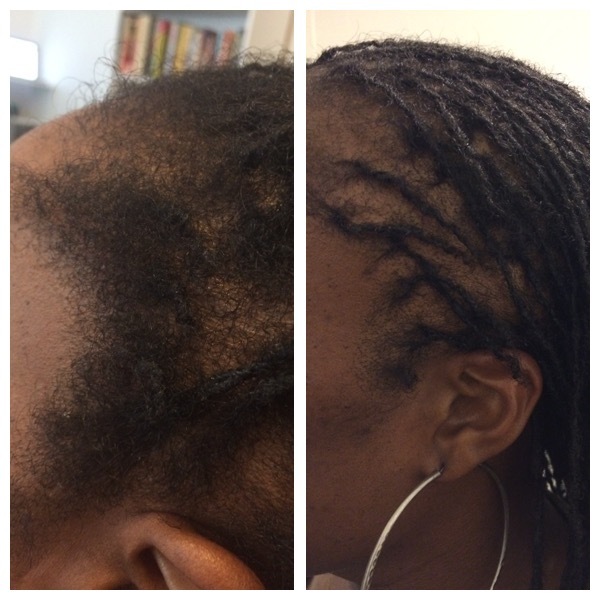 Micro locs Boxer Braids Dreads Micro Locks Micro Dreads Dreadlocks ...
