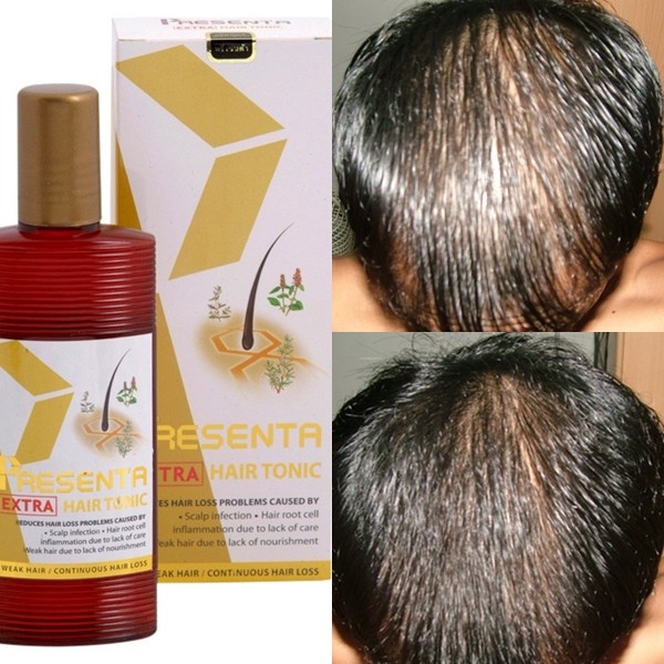 HSR Med BROWN 4 Bottles Hair So Real Hair Loss Concealer Hair Building Fibers