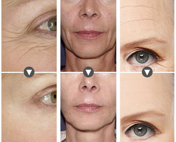 ,face Eye Anti-aging Wrinkle Serum