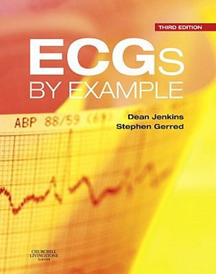 ECGs by Example Paperback Stephen John, Jenkins, Dean Gerred