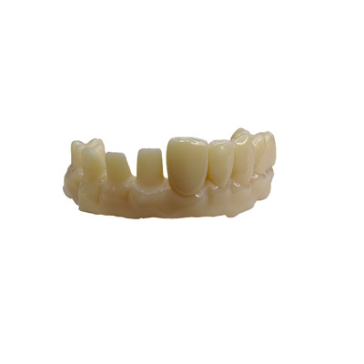 Dentca 3D Printer Crown & Bridge Resin 1kg, Shade: A3
