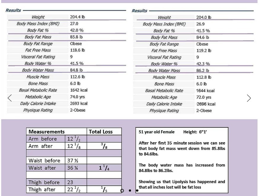 Infra-Slim Body Contouring System / Suit (pressotherapy ; infrared pressure)