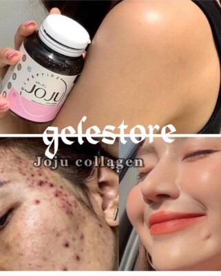 Joju collagen. Anti Acne, Skin Brightening Sold per 1 Bottle   AUTHENTIC 