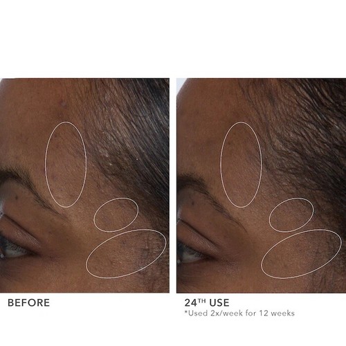 Algenist Blue Algae Vitamin C Dark Spot Correcting Peel 1.5 oz Full Size - New