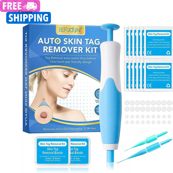 Auto Micro Skin Tag Remover Device Kit Safe Painless Removal