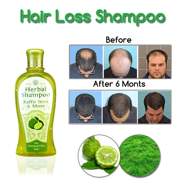 Wan Thai Hair Shampoo Fast Growth Loss Herb Natural Treatment