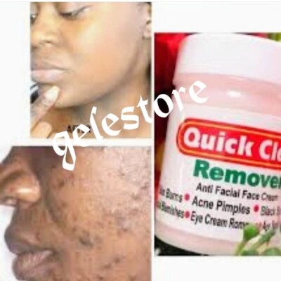 X 2 Jar QUICK clear Pink Sun Burn, & More Face Cream 100% AUTHENTIC 