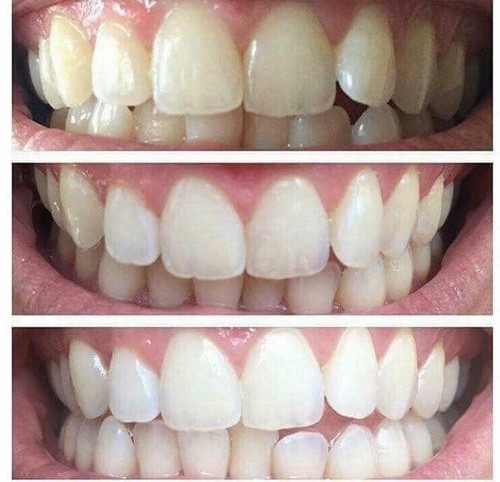 2X Nuskin Nu Skin AUTHENTIC AP24  Whitening Fluoride Toothpaste  Exp05/25