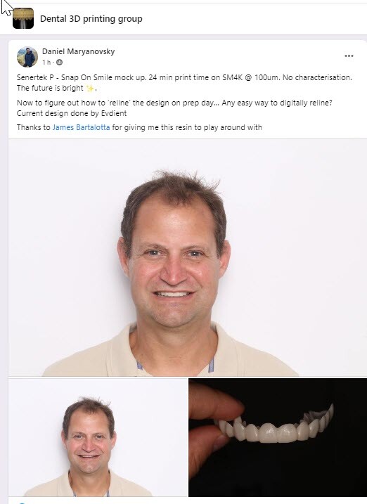 DLP SLA LCD 3d printer permenant crown - teeth resin ..