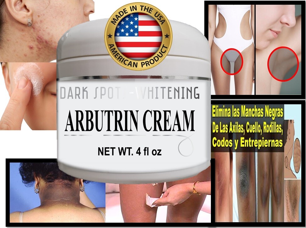 #1 mejor Crema Blanqueadora Aclaradora Para Manchas En La Cara Partes Intimas 4z