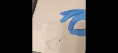 LumiraDx Platform, a high sensitivity point of care diagnostic testing system