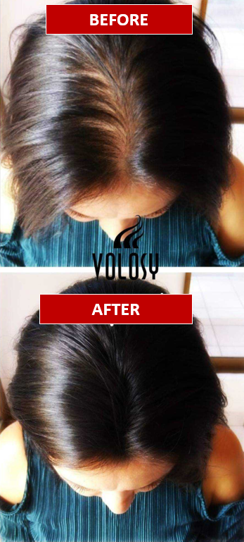 Volosy Instant Hair Building & Thickening Keratin Natural Fibers 27.5g / 0.97oz