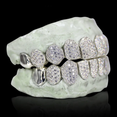 Vvs1 grillz best sale