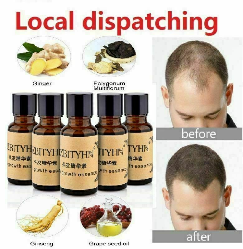 5x Hair Care Hair Growth Essential Oil Natural Dense Fast Sunburst