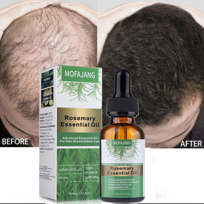 30ml For Hair Growth 100% Pure Natural Therapeutic Grade