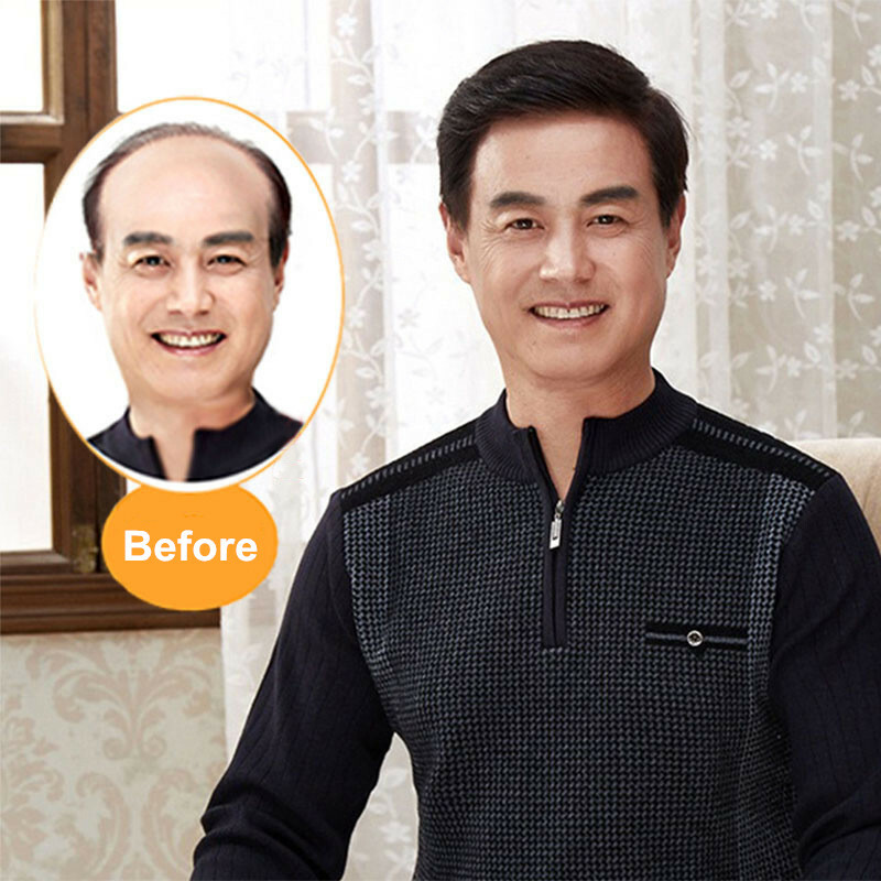 Men Human Hair Toupee Hair Alopecia Replacement System Toupee