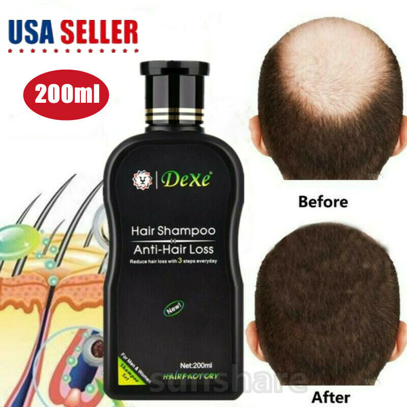 200ml Dexe Original Anti Hair Loss Shampoo Natural Herbal Ha