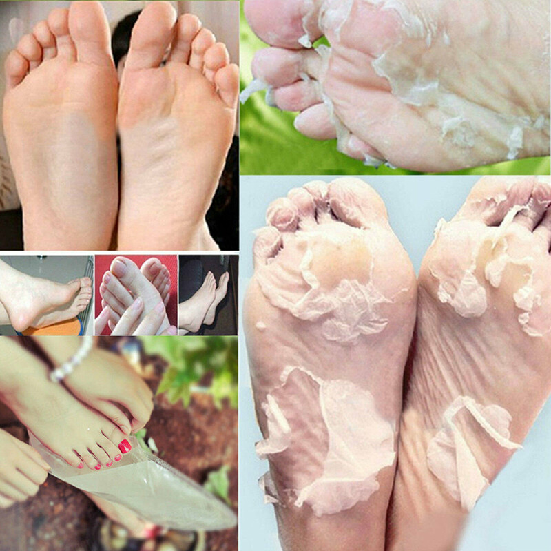 1Paare Feet Fußmaske zur Hornhautenfernung Anti Hornhaut Socken Fuß Peeling Care