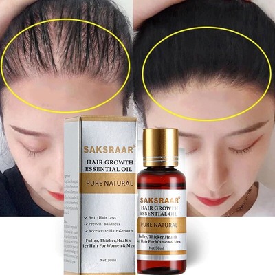 Loss Hair Growth Haircare Lotion Organic Natural Oil Essential Original Essence