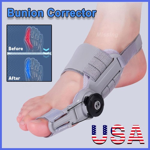Treatmedy Bunion Fix Toe Valgus Corrector Adjustable Orthosis Splints Women Men 