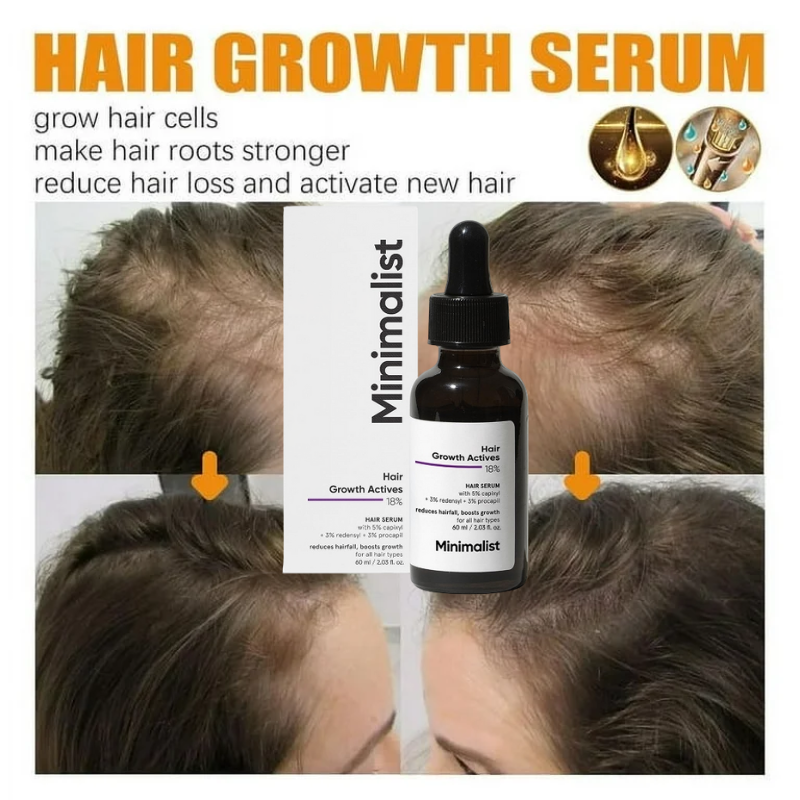 Minimalist Hair Growth Actives Serum For Hair Fall Control