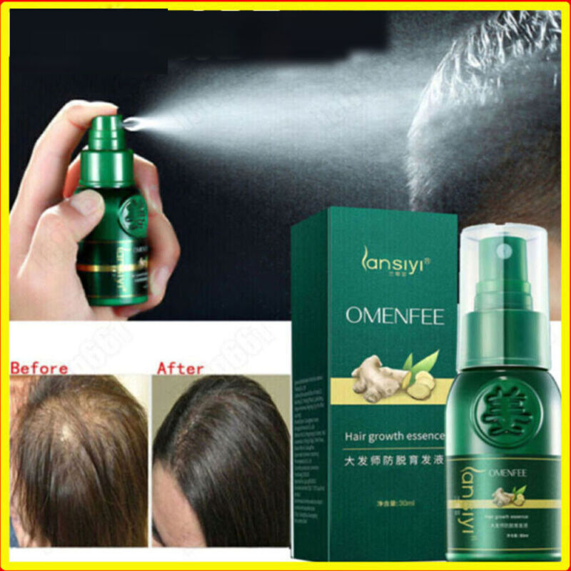 Loss Treatment Us