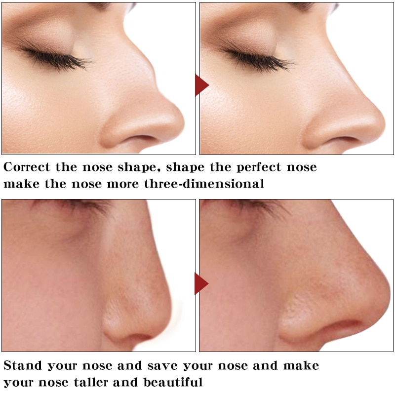 Nose description