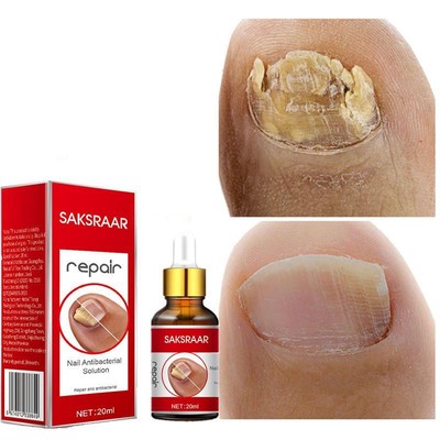 SAKSRAAR NAIL TREATMENT SERUM Repair Serum 20ml