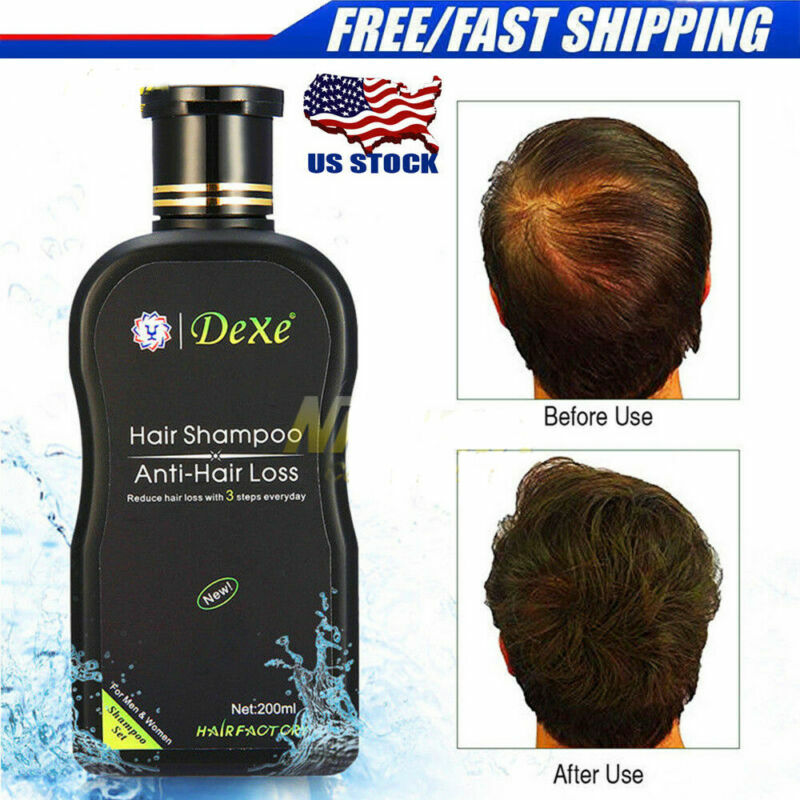 Nanogen Hair Growth Factor Treatment Serum For Men 30ml For Sale