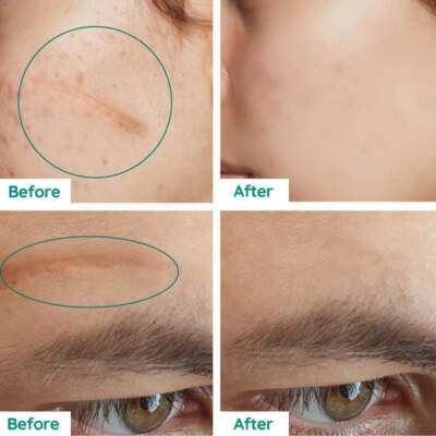 Moisturizing Scar Repair Skin Toner Smoothing Acne Repair Crocodile Serum 40ml