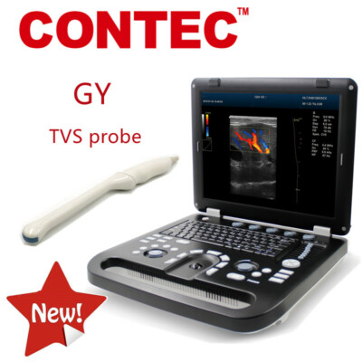 CONTEC Color Doppler ultrasound Biopsy Guide IVF BY TVS in-vitro fertilization