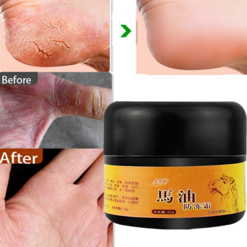 Foot Cream, Instantly Hydrates & Moisturizes Cracked Or Callused Feet,