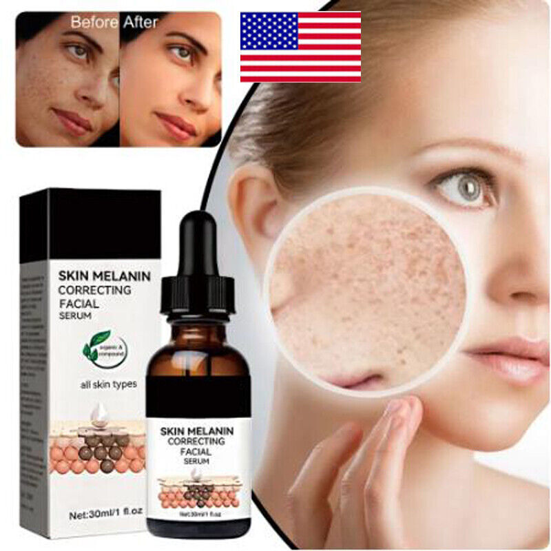 Hyperpigmentation Correcting Facial Serum, GFOUK Melanin Correcting Facial 30ml