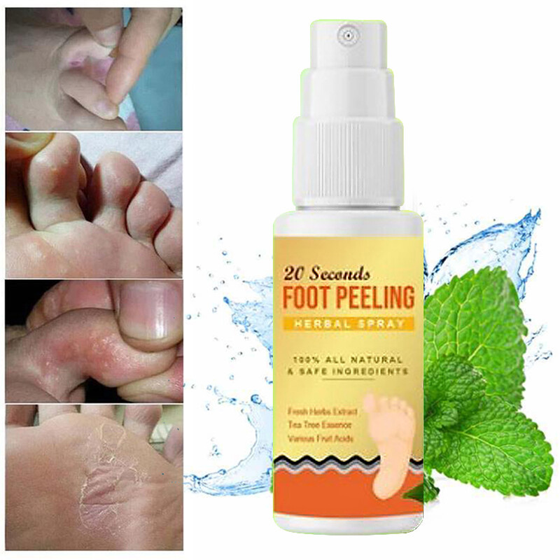30ml Fußpilz Spray Fußspray Athlete Foot Spray Die effizient Juckreiz und Entzü