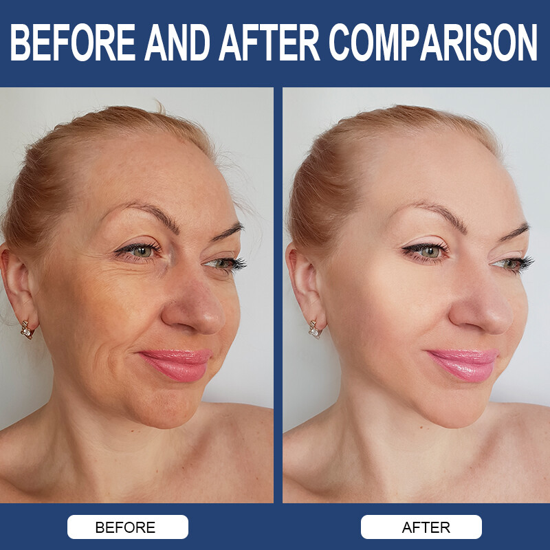 Collagen Hyaluronic Acid Vitamin C Capsules AntiAging Wrinkles Skin Joint Health