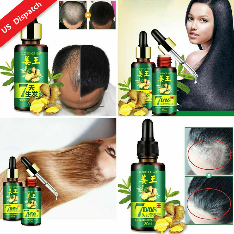 1pcs For Ginger Hair Growth Liquid 7 Days Effective 100 Natural