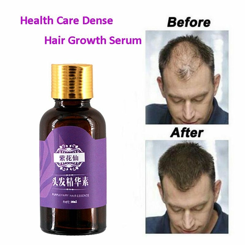 20ml Fast Hair Growth Faster Grow Hair Regrowth For Men Women Pure