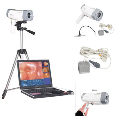 Carejoy Best Color Sony Camera Electronic Colposcope 480k Pixels Software+Tripod