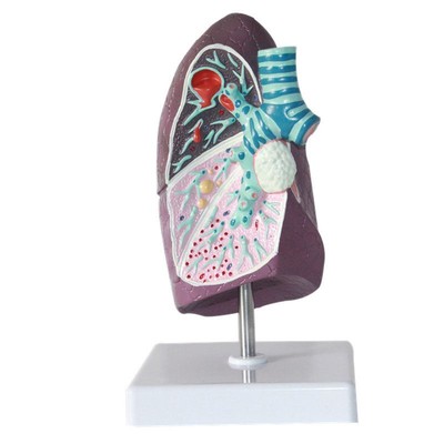 Human Pathological Pulmonary Model Anatomy Respiratory Medical Teaching Tools