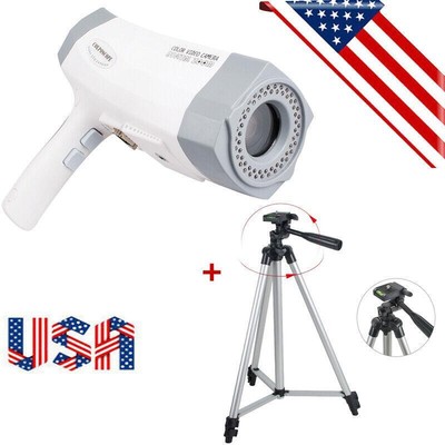 Portable Digital Electronic Colposcope Vaginal Image  480,000 Pix Camera Tripod